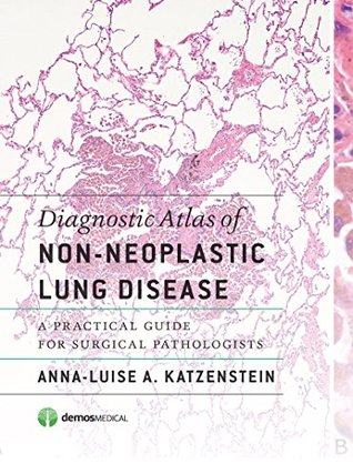 Full Download Diagnostic Atlas of Non-Neoplastic Lung Disease: A Practical Guide for Surgical Pathologists - Anna-Luise A. Katzenstein file in ePub