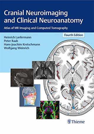 Read Online Cranial Neuroimaging and Clinical Neuroanatomy: Atlas of MR Imaging and Computed Tomography - Heinrich Lanfermann | ePub